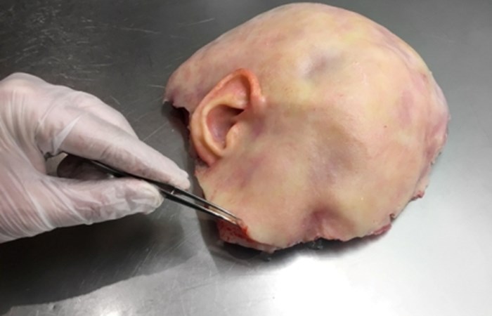 Spare Parts:Rethinking Human Repair